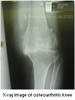 Image of the internal knee